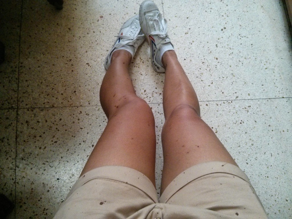 The aftermath, my blood-splattered legs, on my shoes, shorts, shirt, bag and even some on my face.
